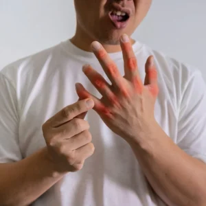 손_통증