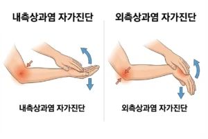 자가진단